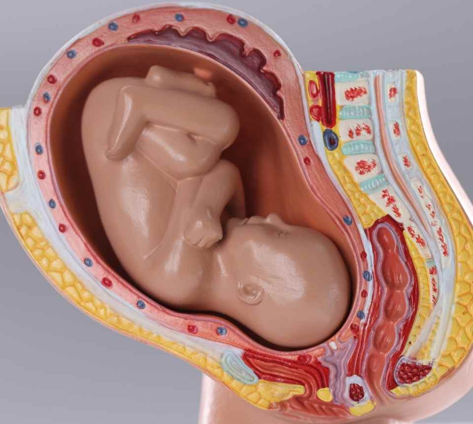Interventional radiology procedure related to gynecology and obstetrics performed in Havelian.
