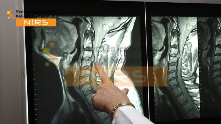 Radiologist performing TACE treatment in Islamabad using image-guided transarterial chemoembolization for liver cancer care