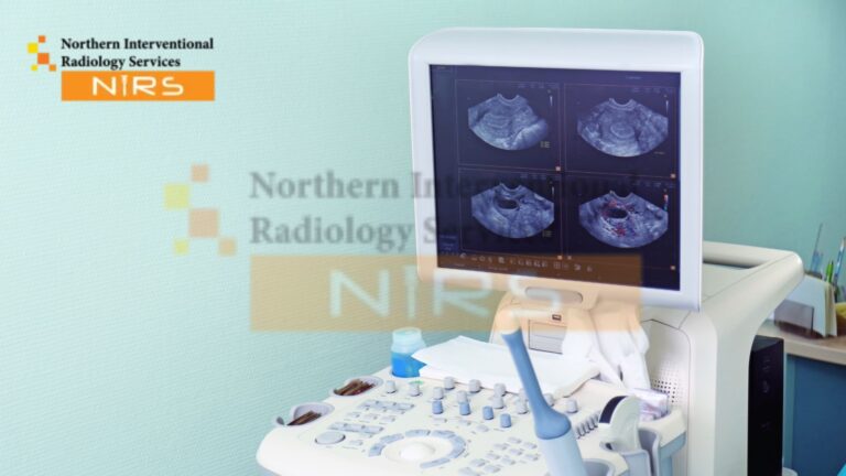 Radiologist performing ultrasound-guided breast wire localization placement in Islamabad using advanced imaging for accurate lesion marking