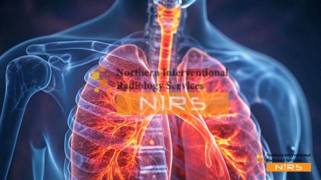 3D Imaging and Robotics in Interventional Radiology enhance tumor targeting, vascular navigation, and complex interventions, allowing radiologists to perform treatments with improved accuracy.