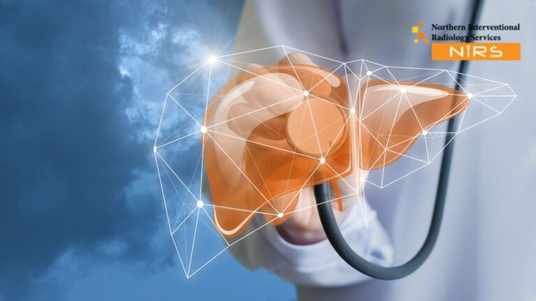 Advanced TACE treatment in Multan performed by expert interventional radiologists using state-of-the-art angiography technology for liver cancer care.