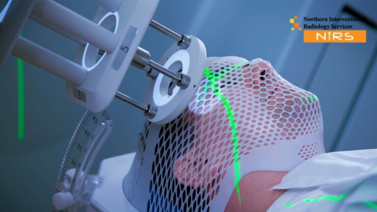 Expert neurosurgeon at NIRS Multan performing advanced brain and spine surgery with modern technology. The procedure ensures safe, precise, and effective neuro care for patients seeking trusted neurological treatment in Multan with professional medical expertise.