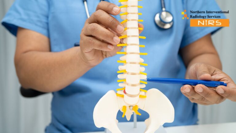 Experience the best sciatica treatment in Multan with NIRS Experts, offering advanced pain relief, accurate diagnosis, and non-surgical care for long-term recovery.