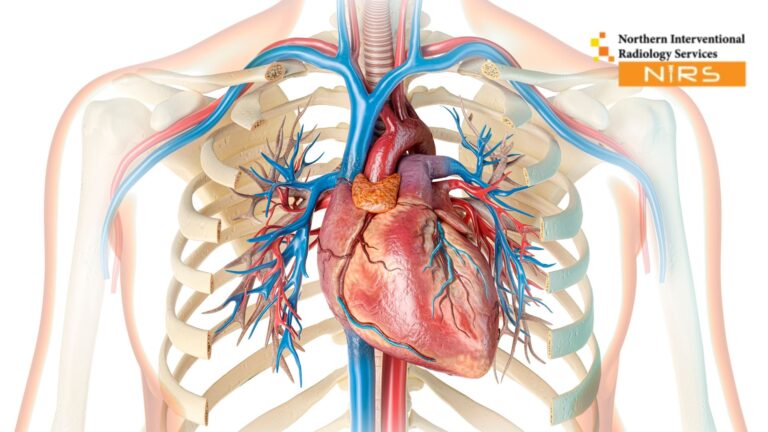 A highly skilled NIRS cardiologist performing advanced heart angiography in Multan using state-of-the-art imaging technology for accurate diagnosis of coronary artery blockages, ensuring precision, safety, and expert cardiac care in a modern clinical environment.