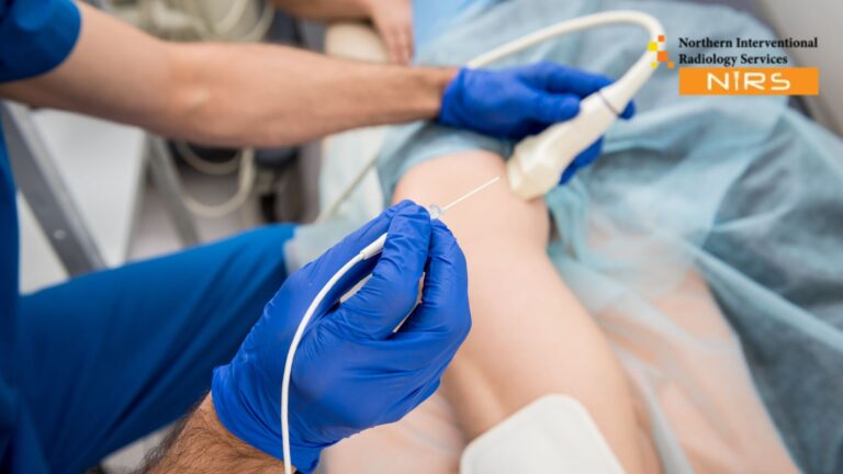 Ultrasound-guided microwave ablation treatment performed by expert interventional radiologists at NIRS Multan, using advanced imaging technology for precise, minimally invasive tumor removal with safe and effective results aimed at liver, kidney, lung, bone, and thyroid tumor management.