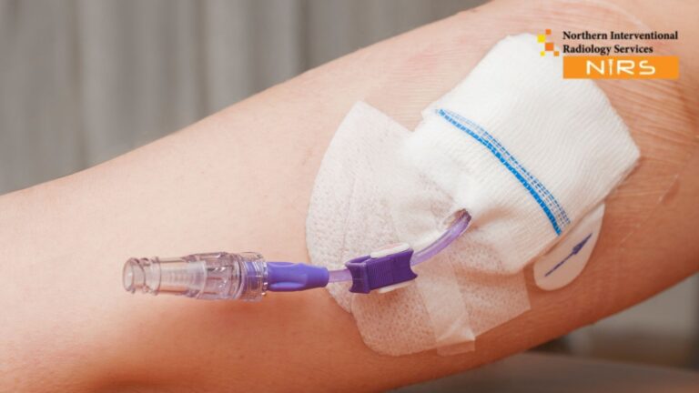 Professional PICC Line Insertion Treatment in Multan performed by NIRS expert