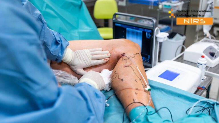 Reliable varicose veins treatment in Multan by NIRS Experts using advanced laser therapy and minimally invasive vascular techniques for lasting relief.