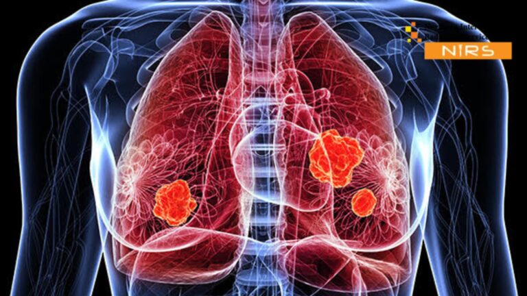 Experienced interventional radiologist performing an ultrasound-guided lung biopsy using real-time imaging for precise and safe lung tissue sampling.