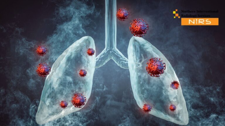 A specialist at NIRS Multan performing an advanced ultrasound-guided lung biopsy using high-resolution imaging technology to collect accurate lung tissue samples safely. The procedure is conducted in a modern clinical environment designed to ensure patient comfort, precision, and expert diagnostic care