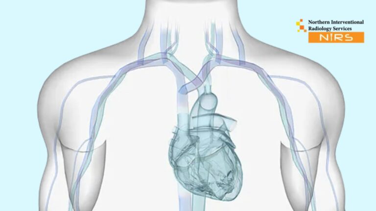 Best Central Venoplasty Canal Road Faisalabad at NIRS – Advanced interventional radiology and minimally invasive vein care in Faisalabad