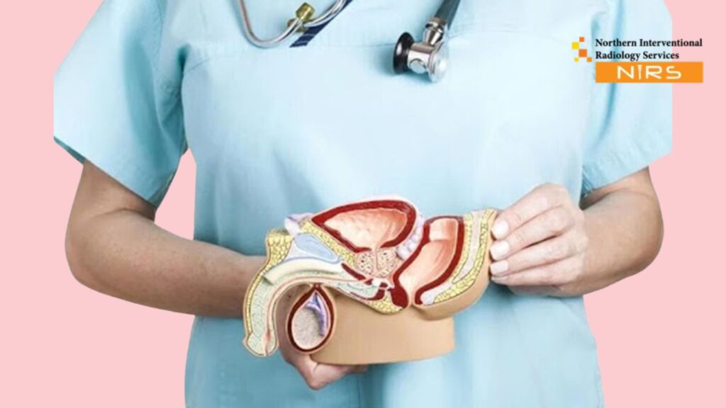 Best Minimally Invasive Varicocele Treatment in Pakistan at NIRS Northern Interventional Radiology Services