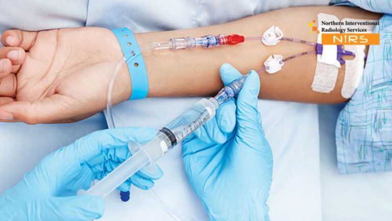 Best PICC Line Insertion in Batala Colony Faisalabad at NIRS – Advanced interventional radiology and safe vascular access care in Faisalabad