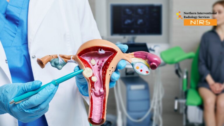 Best Uterine Fibroids Treatment Ghanta Ghar Faisalabad at NIRS – Advanced minimally invasive gynecological care and interventional radiology in Faisalabad