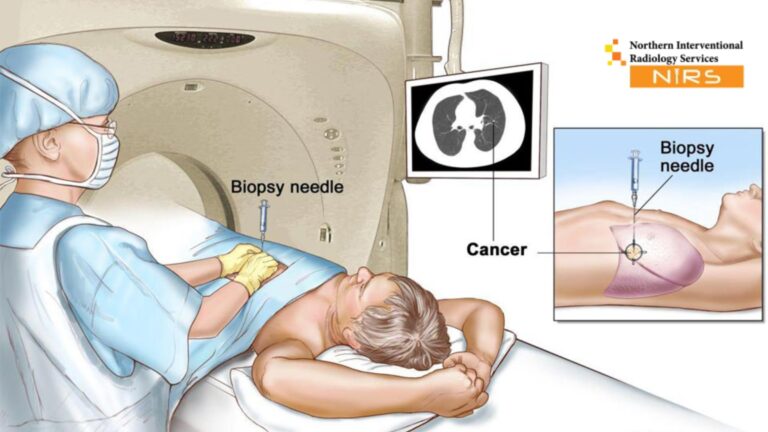 Trusted Interventional Radiology in Clifton by NIRS – Advanced IR Services in Karachi