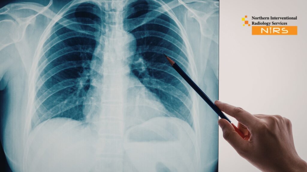 Future of Non-Surgical Care | NIRS delivering advanced, minimally invasive treatments with expert interventional radiologists, modern imaging technology, and patient-centered solutions for faster recovery and effective outcomes.