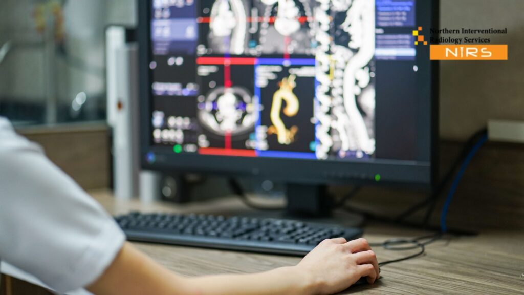 Powerful How Interventional Radiology Is Replacing Surgery Today demonstrating minimally invasive, image-guided procedures that reduce risks, shorten recovery, and provide effective treatment alternatives with expert radiologists.