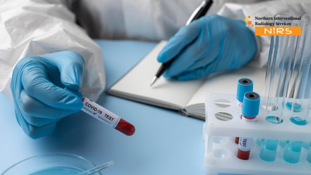 Access Advanced TACE Treatment in Abbottabad for liver cancer through minimally invasive interventional radiology at Northern Interventional Radiology Services.