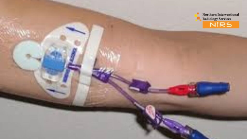 Access the Best Angiography in Abbottabad featuring advanced Cardiac CT and digital subtraction imaging at NIRS and Ayub Teaching Hospital.