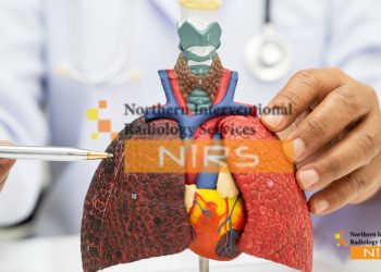 liver cancer treatment with interventional radiology at NIRS Pakistan, showcasing expert radiologists performing TACE (Transarterial Chemoembolization) and Radiofrequency Ablation (RFA) procedures. Using advanced imaging and catheter-based technology, NIRS offers targeted tumor therapy that minimizes side effects and maximizes recovery.