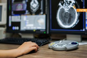 Smart Uterine Fibroid Embolization vs Surgery Guide | NIRS comparing minimally invasive embolization with traditional surgery, highlighting faster recovery, reduced complications, and effective relief from uterine fibroids.