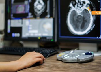 Smart Uterine Fibroid Embolization vs Surgery Guide | NIRS comparing minimally invasive embolization with traditional surgery, highlighting faster recovery, reduced complications, and effective relief from uterine fibroids.